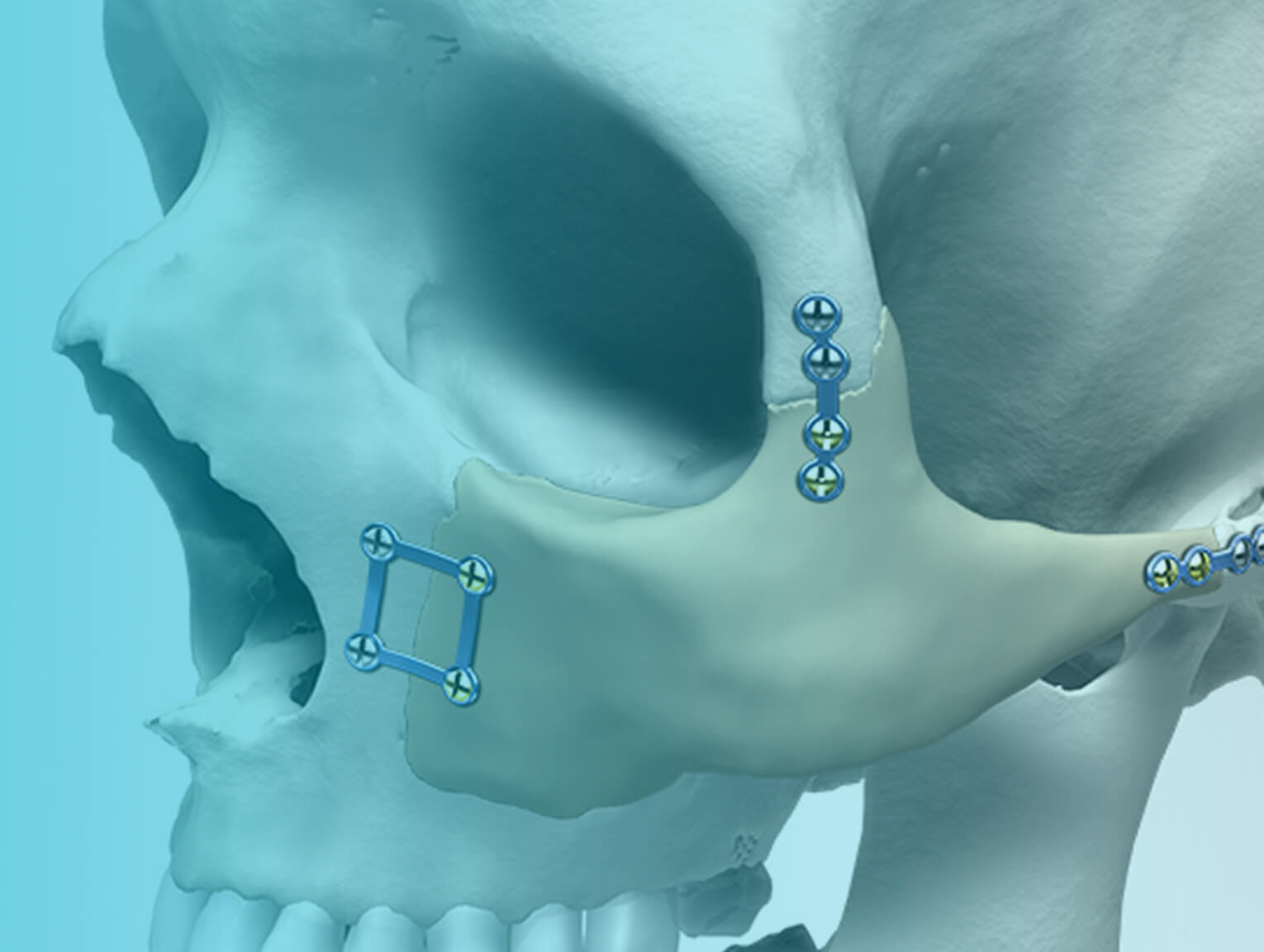 Maxillofacial image